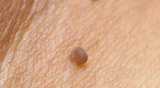 《重生细胞挠挠，惊奇效果你不知道！》（探究重生细胞挠挠在游戏中的作用及科学原理）